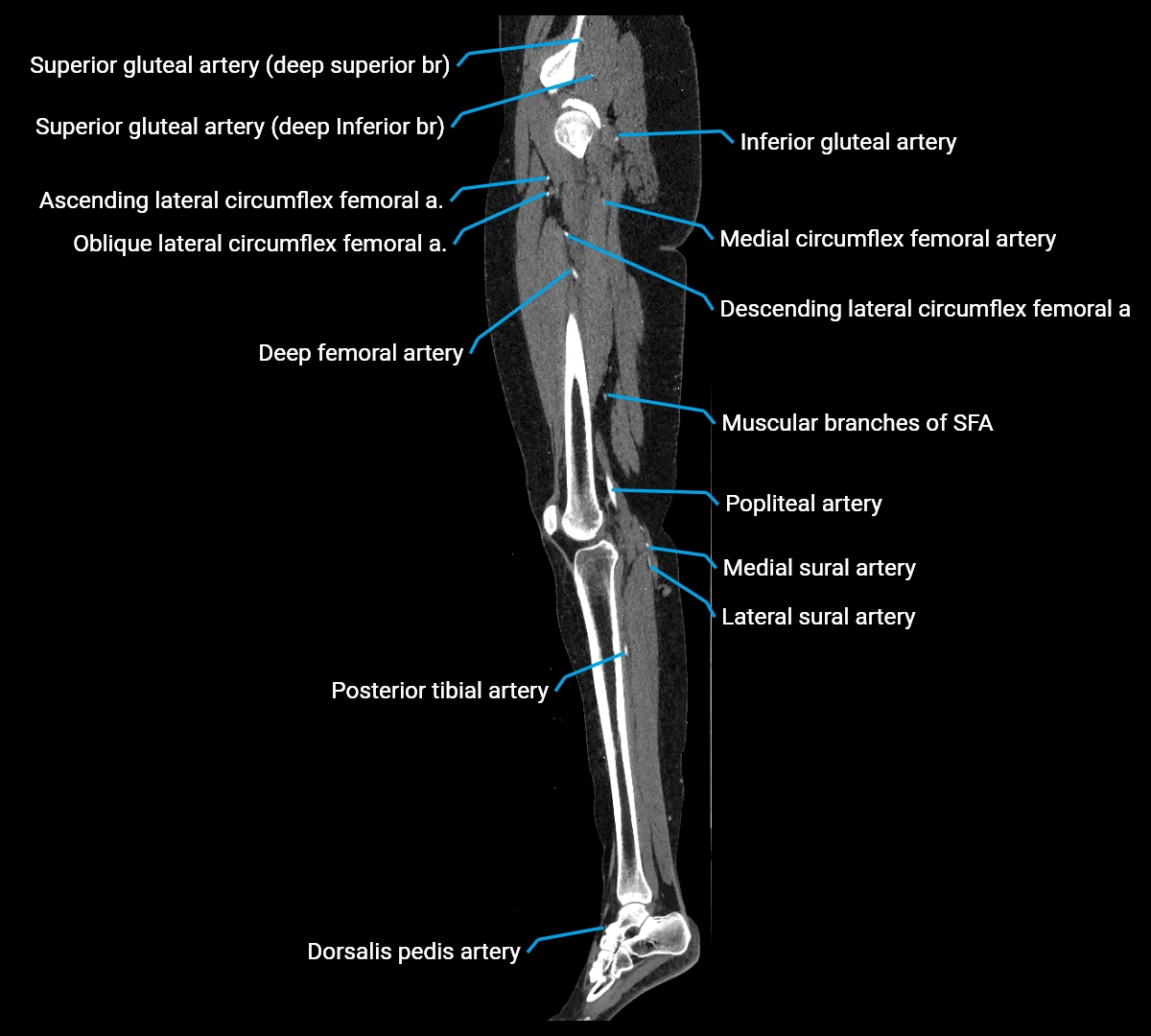 CTA lower limb sagittal cross sectional anatomy labelled image _43 (4).webp